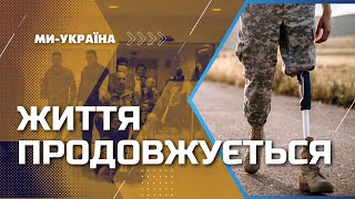 Право на повноцінне життя: Протезування військових у США