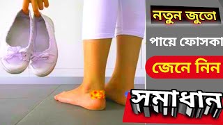 নতুন জুতায় পায়ে ফোস্কা জেনে নিন সমাধান | ফোস্কা পড়লে করণীয় |New shoe blisters