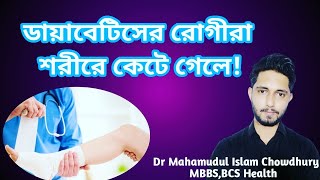 ডায়াবেটিস রোগীদের শরীরে কেটে গেলে কি করবেন?প্রশ্নোত্তর পর্ব