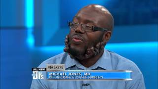 Surgeon Discusses Treatment for Keloids