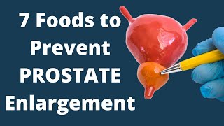 Eat These 7 Foods to Prevent Prostate Enlargement | VisitJoy
