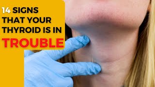 HOW TO FIND THYROID PROBLEM AT HOME | KNOW THE SIGNS OF THYROID DISEASE