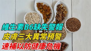 維生素B6缺失警報！皮膚三大異常預警，速補以防健康危機【健康綠動力】#健康 #科普 #養生 #中老年生活 #老年 #老年生活 #分享