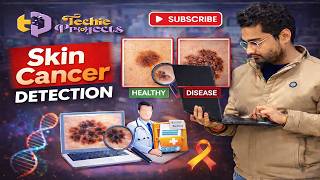 Skin Cancer Detection using Machine Learning | Machine Learning Projects for Final Year