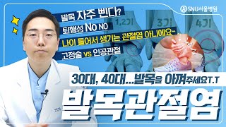 발목관절염...나이 들어서 생기는 관절염이 아니다? 고정술vs인공관절 #SNU서울병원 #이동오원장