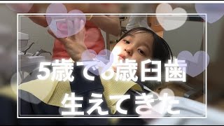 5歳で6歳臼歯生えてきた　｜原歯科医院【調布市・八雲台・布田駅】