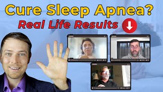 Cure Sleep Apnea Naturally With These 5 Real Life Patient Secrets