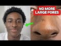 Best Ways to Get Rid Large Pores QUICKLY!