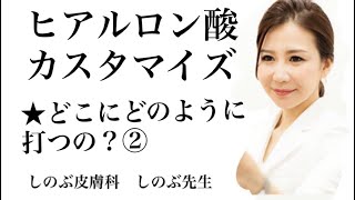 ②ヒアルロン酸注射で良く聞かれる質問は、「どこにどのように打ちますか？」ということです。ご説明致しますね。その２