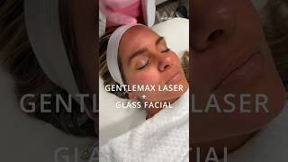 Pair your next facial at Wise Med Spa in Wayne NJ with the GentleMax Pro laser for maximized results