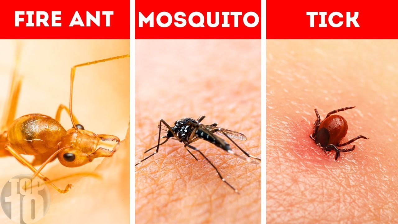 10 Bug Bites You Need To Be Able To Identify Youtube 10 Bug Bites You Need To Be Able To Identify Youtube