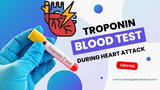 Troponin test for heart attack | Troponin I and Troponin T | Cardiac troponins | Trop t | Trop i