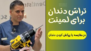 مقایسه مقدار تراش دندان برای  انجام لمینت سرامیکی دربرابر مقدار تراش لازم برای روکش کردن دندان