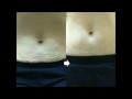 galvanic body spa before and after treatment my nu skin sponsor claremont college