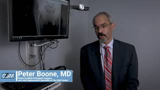 Who is an Ideal Candidate for Outpatient Hip Replacement? Peter Boone, MD