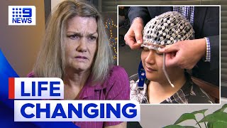 Woman with chronic epilepsy now seizure-free | 9 News Australia