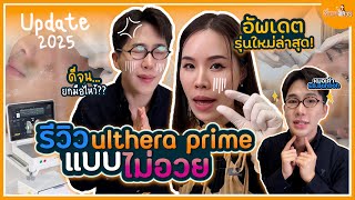 รีวิว Ulthera prime ตัวใหม่ เจ็บไม่เจ็บไปดูกัน ?! @EB.Bahboh