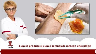 Cum se produce si cum e semnalata 👉 infectia unei plagi?