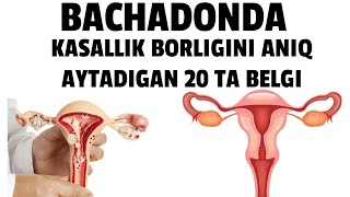 BACHADONDA KASALLIK BORLIGINI ANIQ AYTADIGAN 20 TA BELGI HAQIDA BATAFSIL MA'LUMOT