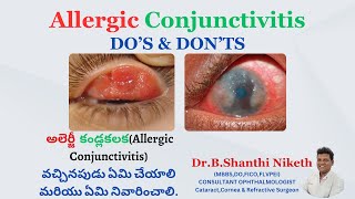 Allergic conjunctivitis-Do's \u0026 Don'ts అలెర్జీ  కండ్లకలక వచ్చినపుడు ఏమి చేయాలి మరియు ఏమి నివారించాలి.