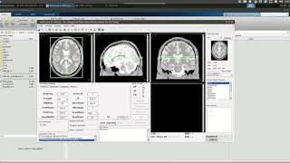 MRiLab ISMRM 2019 Video Demo #1: Run a Simple MRI Simulation using Gradient Echo Sequence