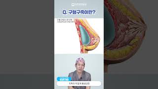 가슴수술의 부작용, 구형구축! 도대체 뭔가요?! #구형구축 #shorts