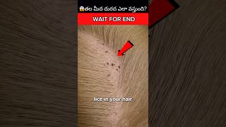 😱తల మీద దురద ఎలా వస్తుంది?|🔥intresting facts in telugu| #shorts #facts #viral