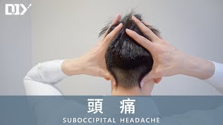 頭痛 Suboccipital Headache│DIY 教室