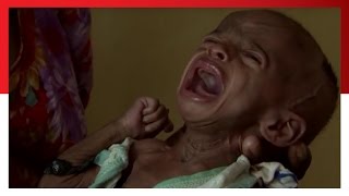 THIS is Hunger  | Save the Children