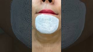 easy way to remove chin Whitehead & blackhead at home remedy♥️#shorts #youtubeshorts #trendinghacks