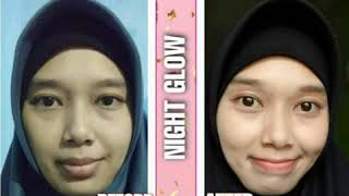 testimoni justmine beauty skincare normal skin