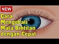 Cara Mengobati Mata Bintitan dengan Cepat