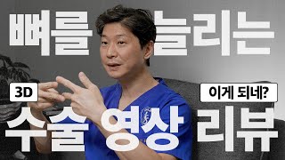 키수술이 이런데도 쓰인다고? - 글로벌 탑티어 의사가 설명해주는 키수술의 또 다른 용도