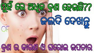 ଗୋଟେ ରାତି ରେ ଠିକ କରନ୍ତୁ Pimple । How To cure pimples in odia । How to remove dark spots in odia