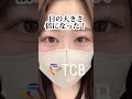 【二重整形】【目頭切開】離れ目解消できる？ shorts tcb 二重整形 目頭切開