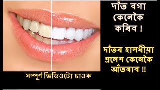 দাত কেনেকৈ ঘৰতে বগা চিকচিকিয়া কৰিব / home remedies white teeth / ঘৰুৱা উপায় / health tips / health