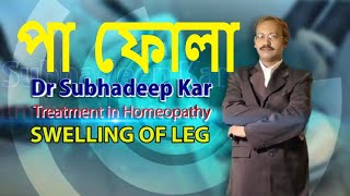 পা ফুলে যাওয়া | পা ফোলা কমানোর হোমিও ঔষধ |