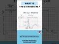 What is the QT interval?