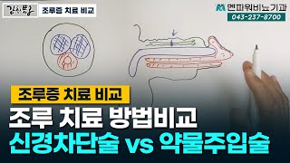 (알기쉬운 그림설명) 조루치료법 비교_배부신경차단술 vs 약물주입술 _멘파워비뇨기과