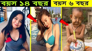 পৃথিবীর সবচেয়ে অস্বাভাবিক ৫টি শিশু । Most 5 unusual kids in the world