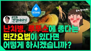 난치병인 루푸스를 완치했다는 민간요법이 있다면, 당신은 어떻게 하시겠습니까?  [닥터유의 건강이야기]