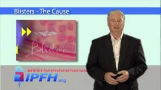 Blisters The Cause