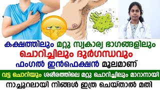 കക്ഷത്തിലും സ്വകാര്യ ഭാഗങ്ങളിലും ചൊറിച്ചിലും ദുർഗന്ധവും മാറാനായി നാച്ചുറലായി നിങ്ങൾ ഇത്ര ചെയ്താൽമതി.