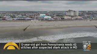 Pa. Girl, 12, Injured In Suspected Shark Attack In Maryland