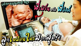 หน้าลูกพี่เฟิร์นในท้อง ฟ้องเลยว่าเหมือนใคร 100%  ULTRASOUND 4D PREGNANT