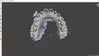 [Beyou-lab]オートデスク社のメッシュミキサーMeshMixerを利用したDental model trimmingとExport方法