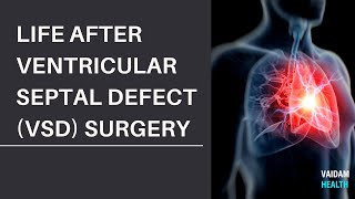 Life after Ventricular Septal Defect VSD Surgery