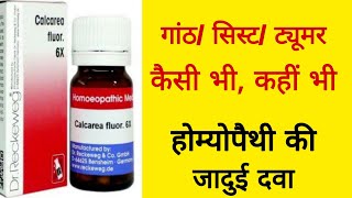 ट्यूमर गांठ को हटाने की बेस्ट मेडिसिन । best Homeopathy medicine of tumor or cyst ।