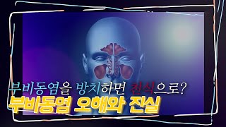 부비동염 방치하면 천식이 될까? | 건강플러스 | 06월 10일