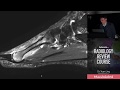 Stress Fracture - Radiology Review Course